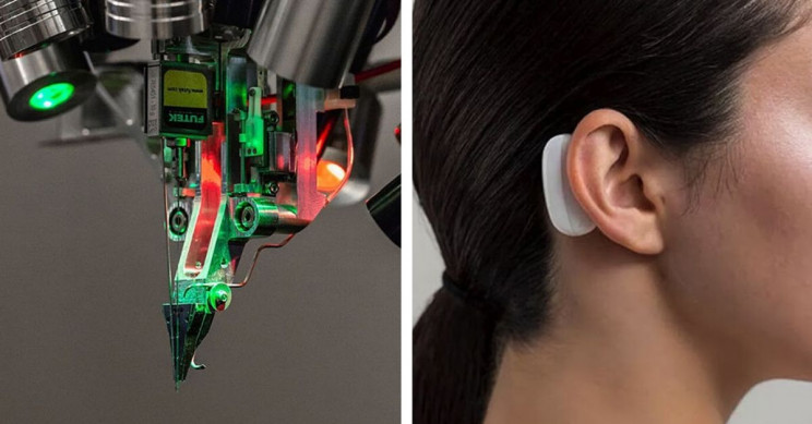 L'impianto visto dall'esterno. Credits: Neuralink