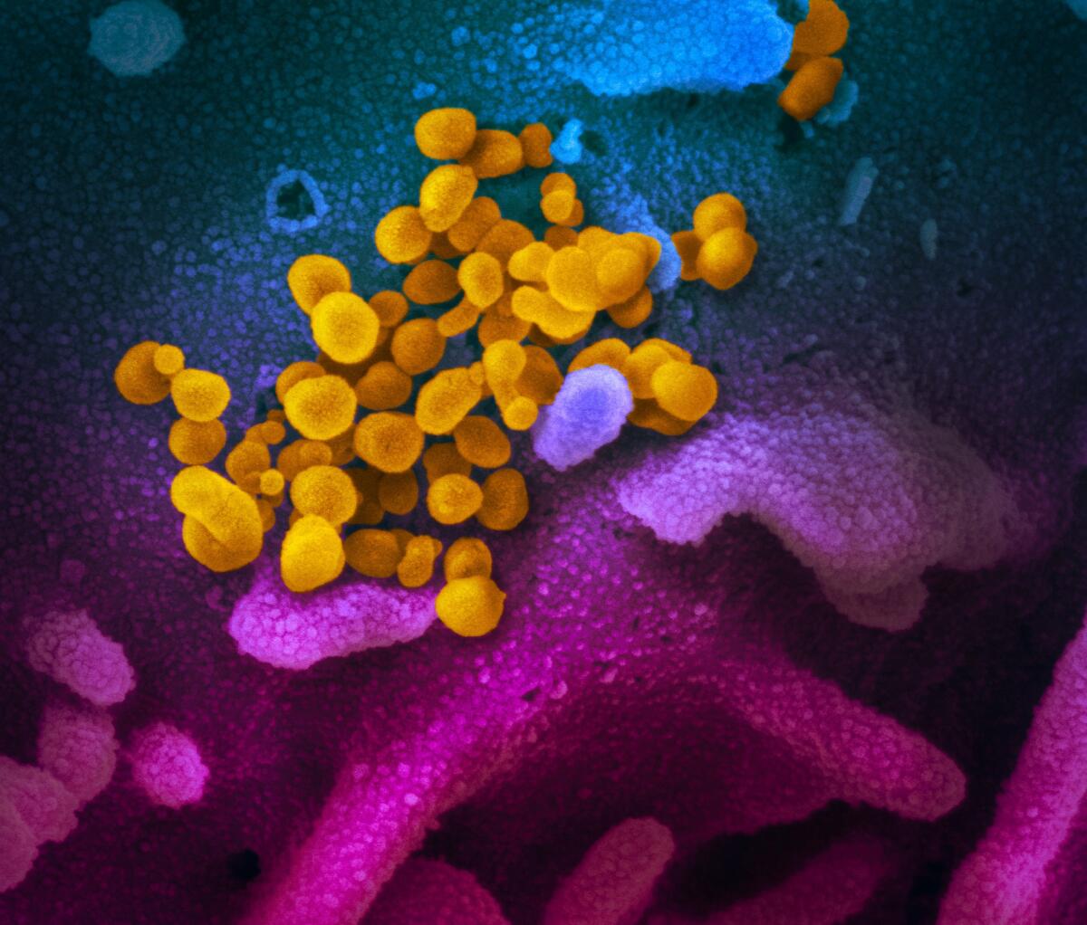 Coronavirus, studio rivela molecole endogene in grado di bloccare l'infezione - Nella foto il SarsCoV2 osservato al microscopio ottico, crediti: NIAID-RML