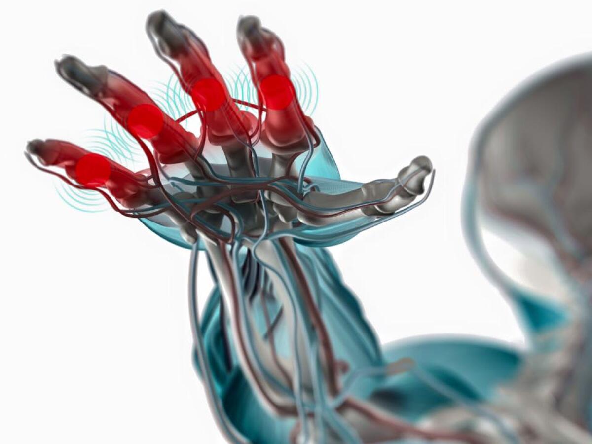 Nervi danneggiati: una guida biodegradabile ne aiuta la rigenerazione - Pagina Facebook: Società Italiana Microchirurgia - SIM
