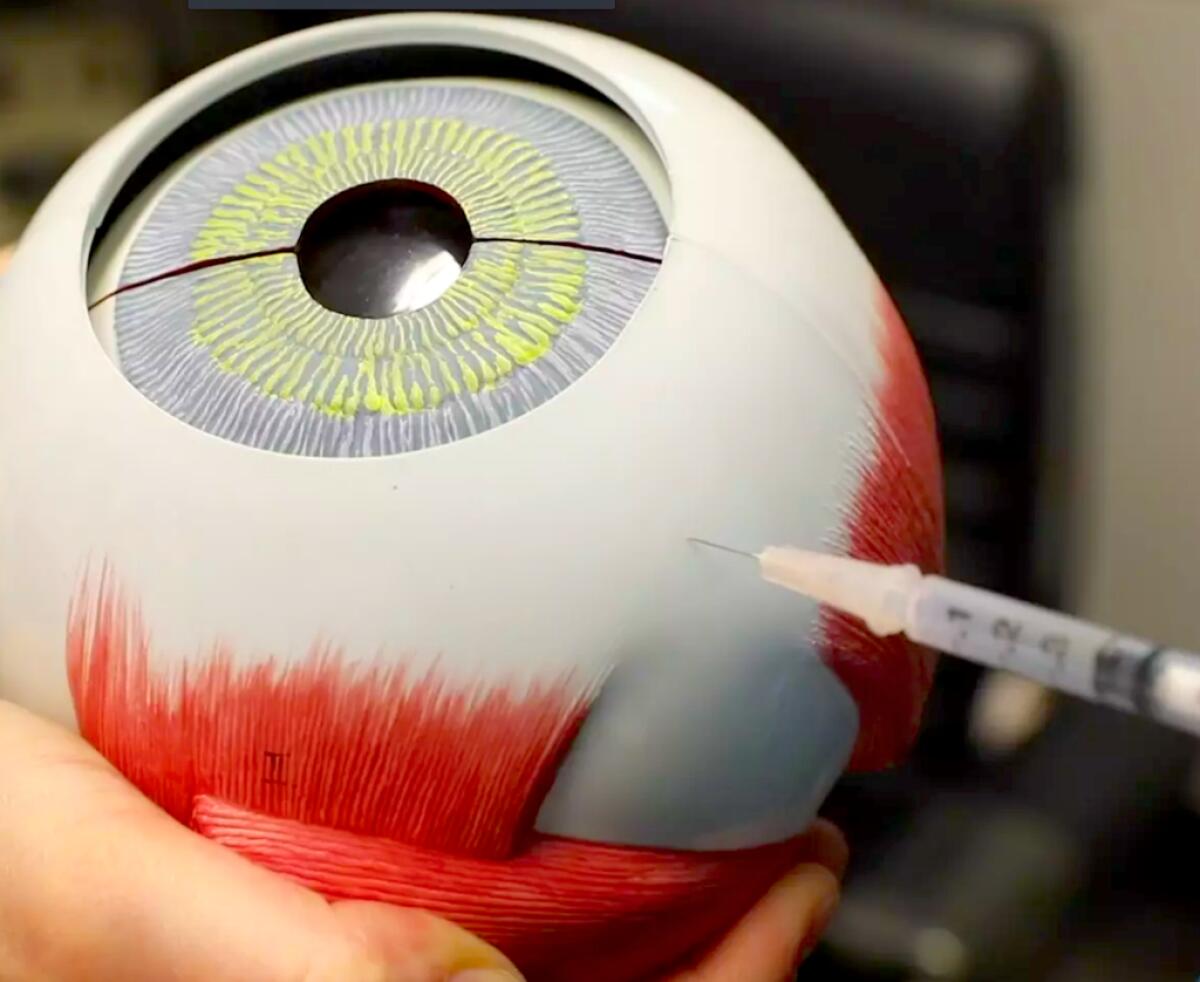 Retina artificiale liquida: lo studio made in Italy per restituire la vista - retina artificiale liquida IIT italia retinite  pigmentosa protesi visive credits: stefanodolceoculista.it