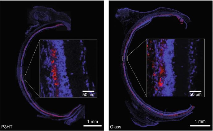 In rosso, la retina artificiale liquida vista con la fluorescenza che si insinua perfettamente sulla conformazione dell'occhio