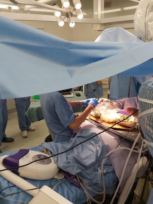 Il team medico in sala operatoria monitora e valuta attentamente la donna, avvisando il chirurgo nel caso in cui le sue azioni dovessero influire sulle funzioni cerebrali. Credits: ANSA
