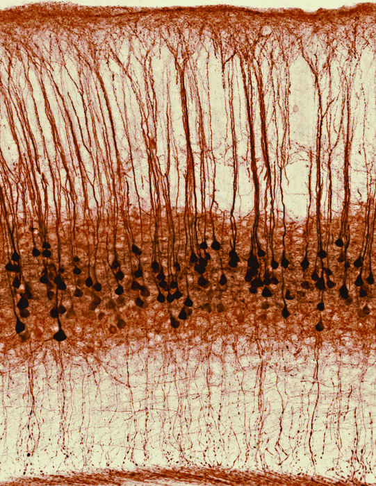Immagine dei neuroni. Credits: Riccardo Beltramo/IIT