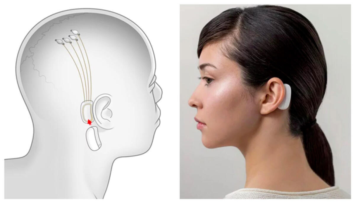 Elon Musk: ascoltare musica col cervello sarà possibile grazie a Neuralink - 