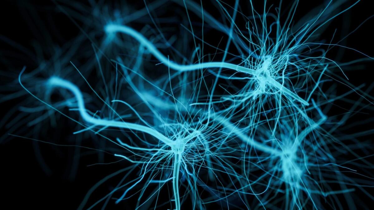Nanoparticelle d’oro per salvare i neuroni dalla morte cellulare - Nanoparticelle d’oro per salvare i neuroni dalla morte cellulare
