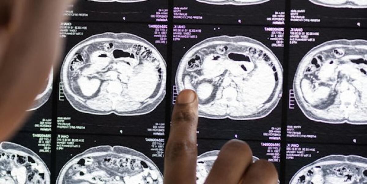 Coronavirus e danni al cervello: l'allarme lanciato da ricercatori inglesi - money.it