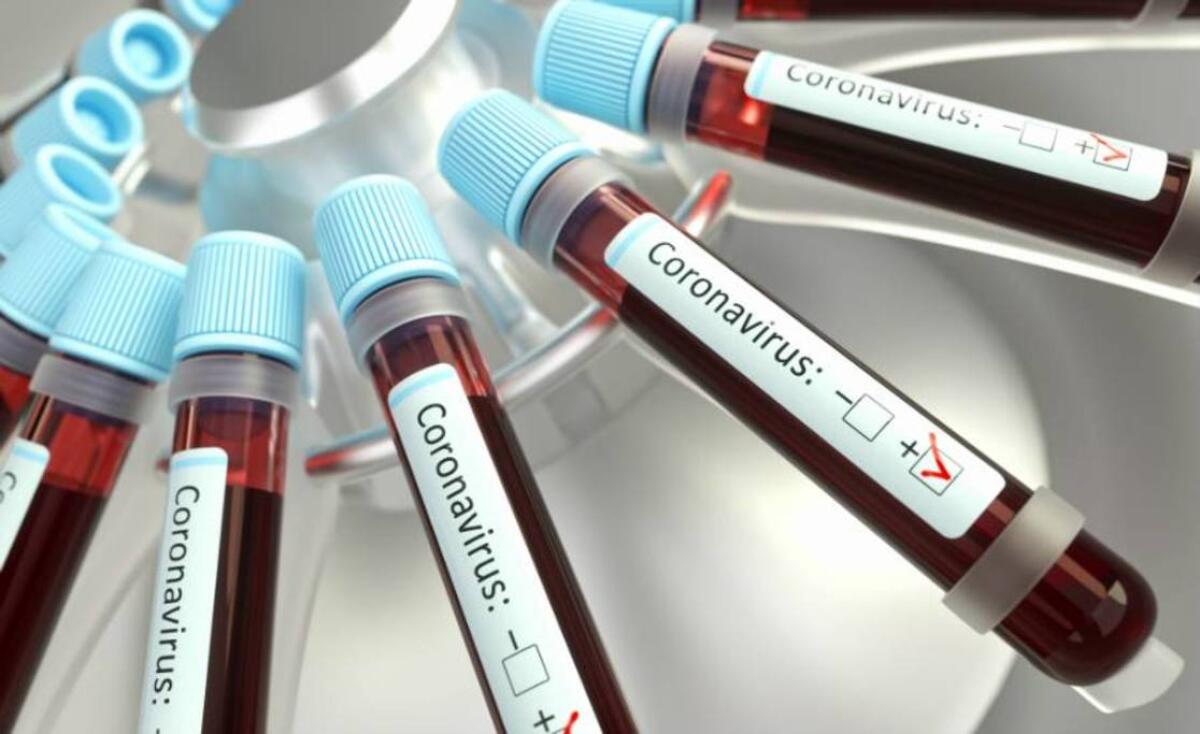 Covid-19, cluster serbo che preoccupa il Veneto, è più contagioso? - 