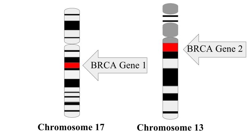 I geni BRCA1 e BRCA2 nei rispettivi cromosomi 17 e 13 Credits: Tessssa13
