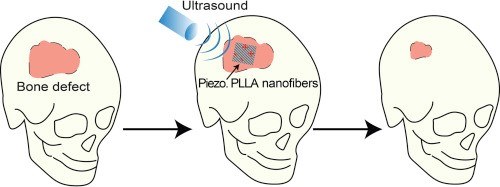 Applicazione degli ultrasuoni sulle nanofibre seminate da cellule può migliorare la differenziazione osteogenica delle cellule staminali.Credits: Nano Energy 2020