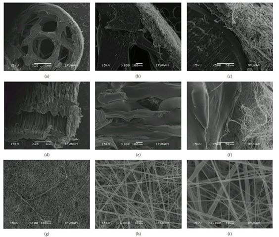 Bioprinting per la rigenerazione ossea con impalcature tubolari rivestite in nanofibreCredits: Febe Carolina Vazquez-Vazquez et al.