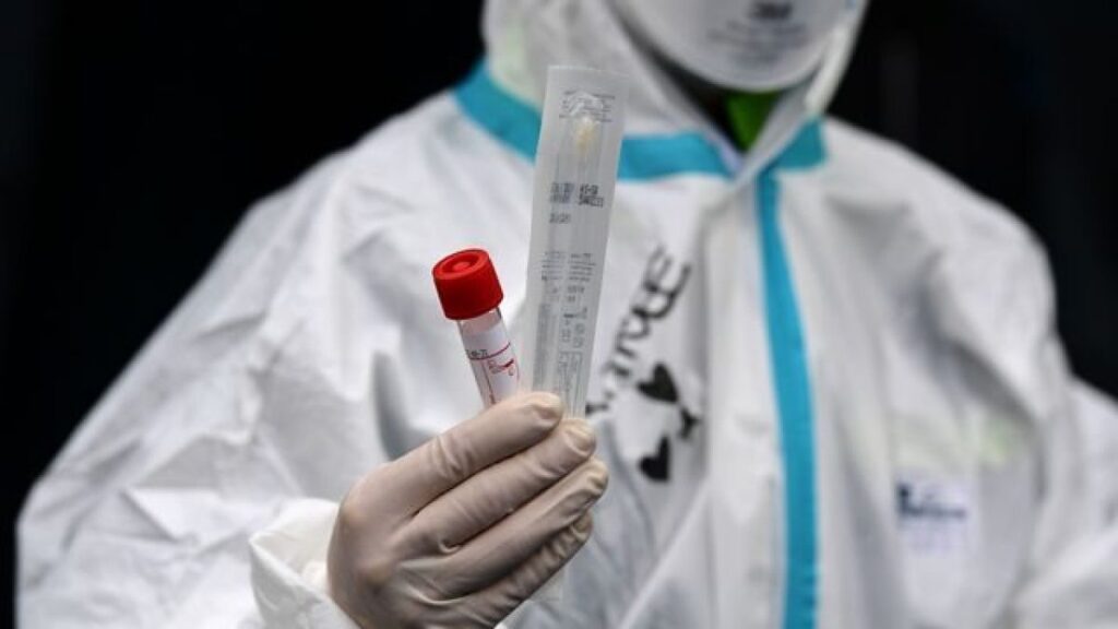 Covid-19, cluster serbo che preoccupa il Veneto, è più contagioso?