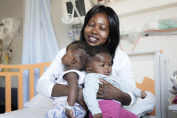 Le bambine siamesi, Ervina e Prefina, insieme alla madre prima dell'intervento.Credits: Ufficio stampa Ospedale Bambino Gesù