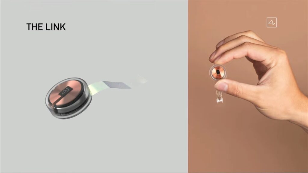 "The Link", il dispositivo impiantabile Neuralink. Credits: Neuralink