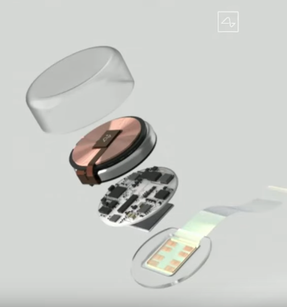 Neuralink v0.9 esploso