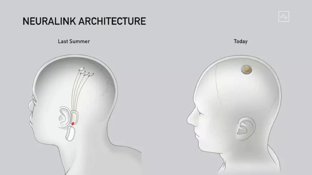 Elon Musk ha presentato un dispositivo notevolmente semplificato rispetto a quello mostrato nel 2019. Credits: Neuralink