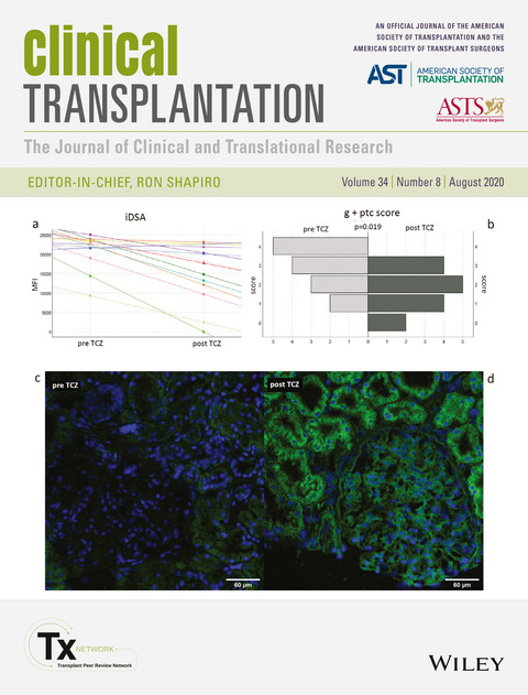 Copertina del mese di agosto della rivista scientifica Clinical Transplantation. Credits: Clinical Transplantation