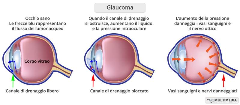 PH: Fondazione Poliambulanza