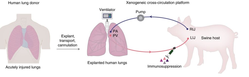 Meccanismo di collegamento tra i polmoni e il maiale.Credits: Nature Medicine