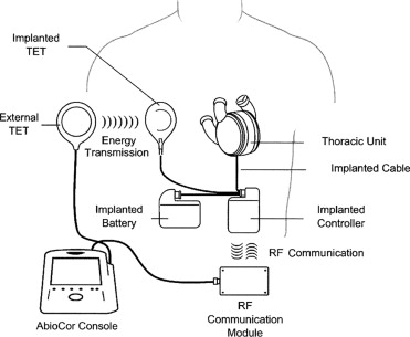 Componenti di AbioCorCredits: Seminars in Thoracic and Cardiovascular Surgery