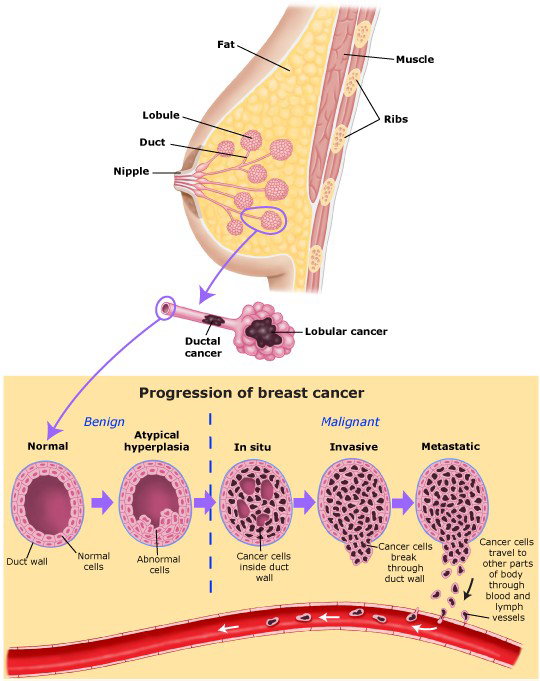 PH: saintjohnscancer.org