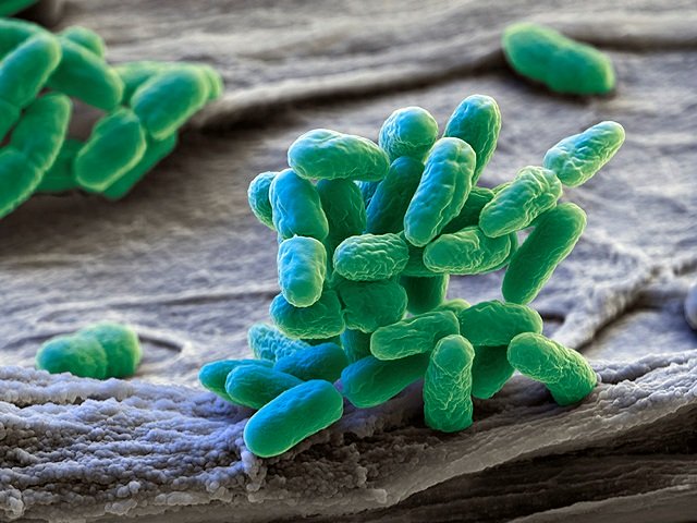 Cianobatteri al microscopio.Credits: Creative Commons