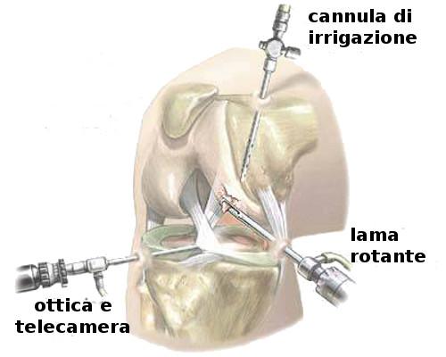 Credits: Fisioterapia Maniscalco
