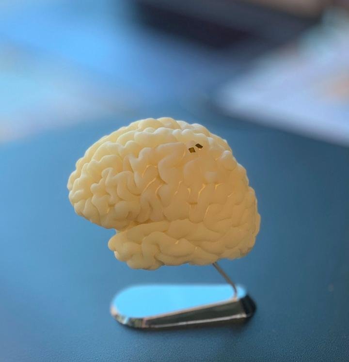 Foto di un impianto neurale che utilizza fili per trasmettere informazioni e ricevere energia. Credits: Sergey Stavisky
