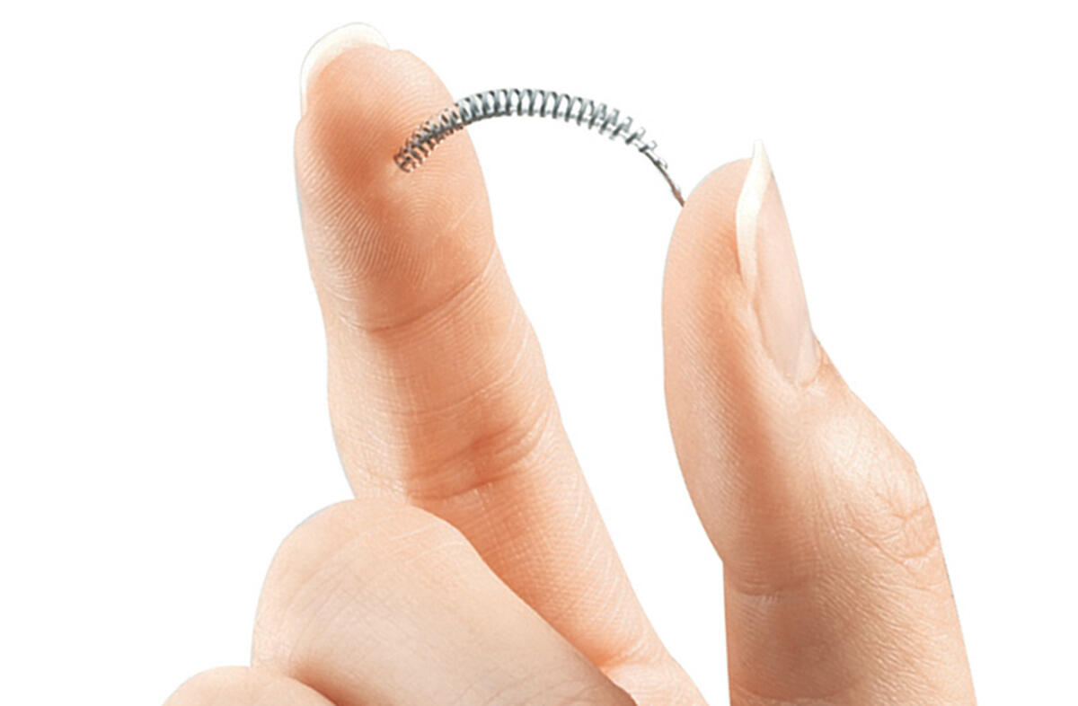 Essure: l'anticoncezionale permanente che ha causato danni a migliaia di donne - Essure - nbcnews.com