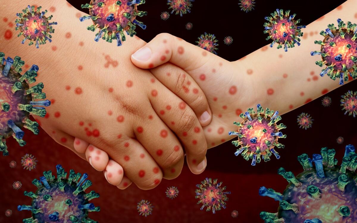 Ti lavi spesso le mani? Sopravvivenza del Covid19 sulla pelle fino a 9 ore - lavarsi le mani sopravvivenza Covid19 igiene corretta batteri funghi coronavirus