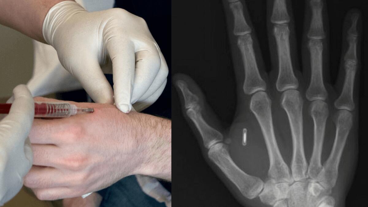 Tecnologia RFID: il futuro a portata di mano - 