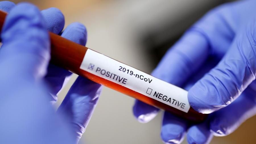 Nuovo dispositivo per diagnosi rapida del Covid 19: basta un solo respiro