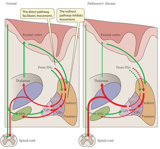 PH: scienceofparkinsons