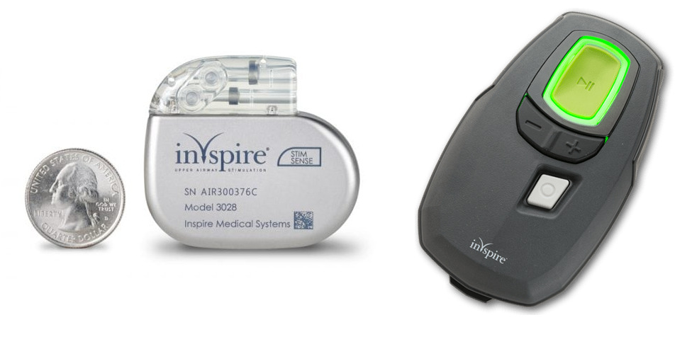 Sistema di stimolazione e telecomando InspireCredits: Hackensack Sleep and Pulmonary Center