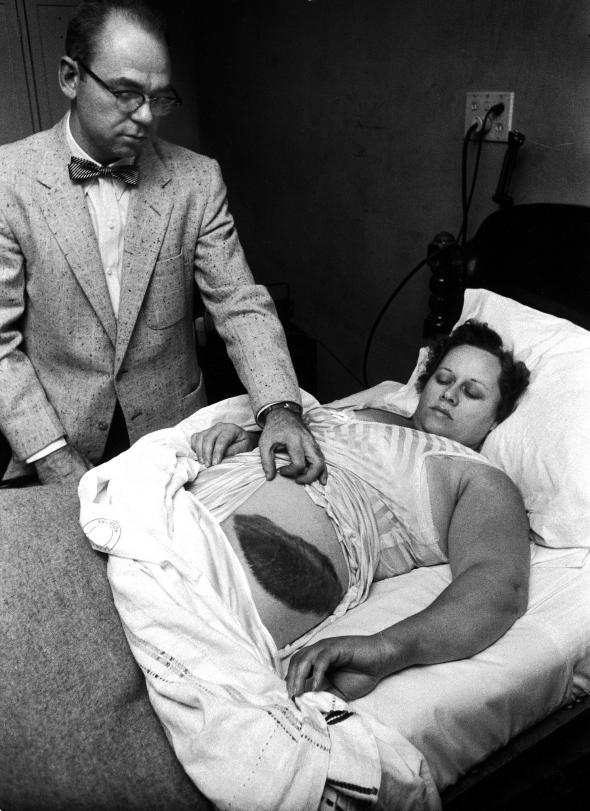 Ann Hodges dopo l'incidente