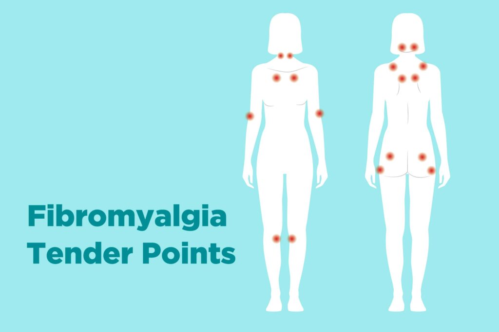 Credits: https://creakyjoints.org