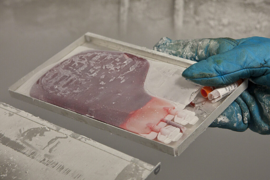 Sangue cordonale conservato - Credits: policlinicogemelli.it