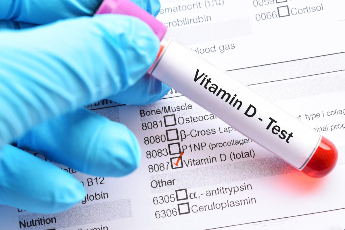 Vitamina D: un nuovo alleato contro il covid? - Credits: New York Times
