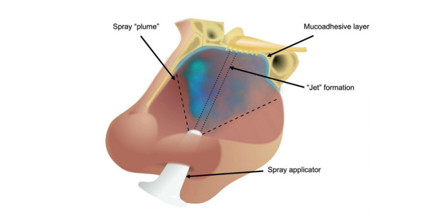 Applicazione dello spray nasale anti-CovidCredits: University of Birmingham