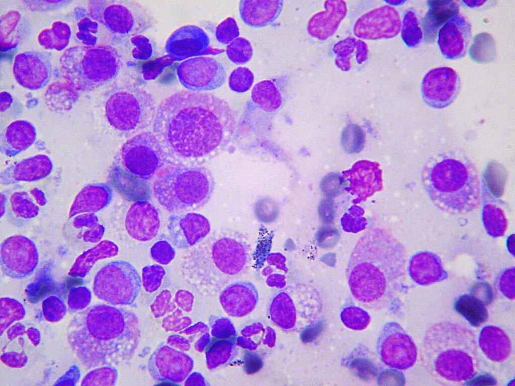 Mastociti al microscopio