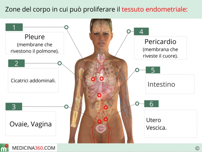 PH: medicina360