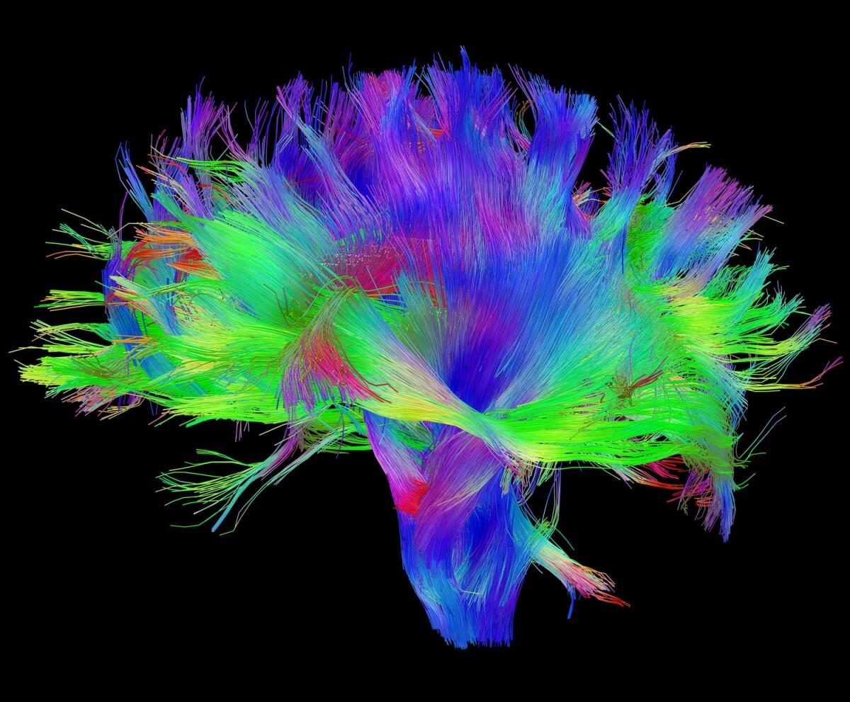 Risonanza magnetica con DTI: l'importante strumento per il neuroimaging - Risonanza magnetica con DTI: l’importante strumento per il neuroimaging. Credits: humanconnectomeproject.org