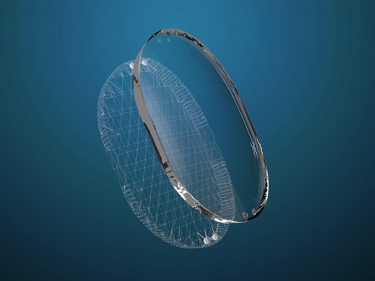 ClearFit, l’impianto che permette l’uso di ultrasuoni per l'imaging cerebrale - ClearFit, l’impianto che permette l’uso di ultrasuoni per l'imaging cerebrale. Credits: Longeviti