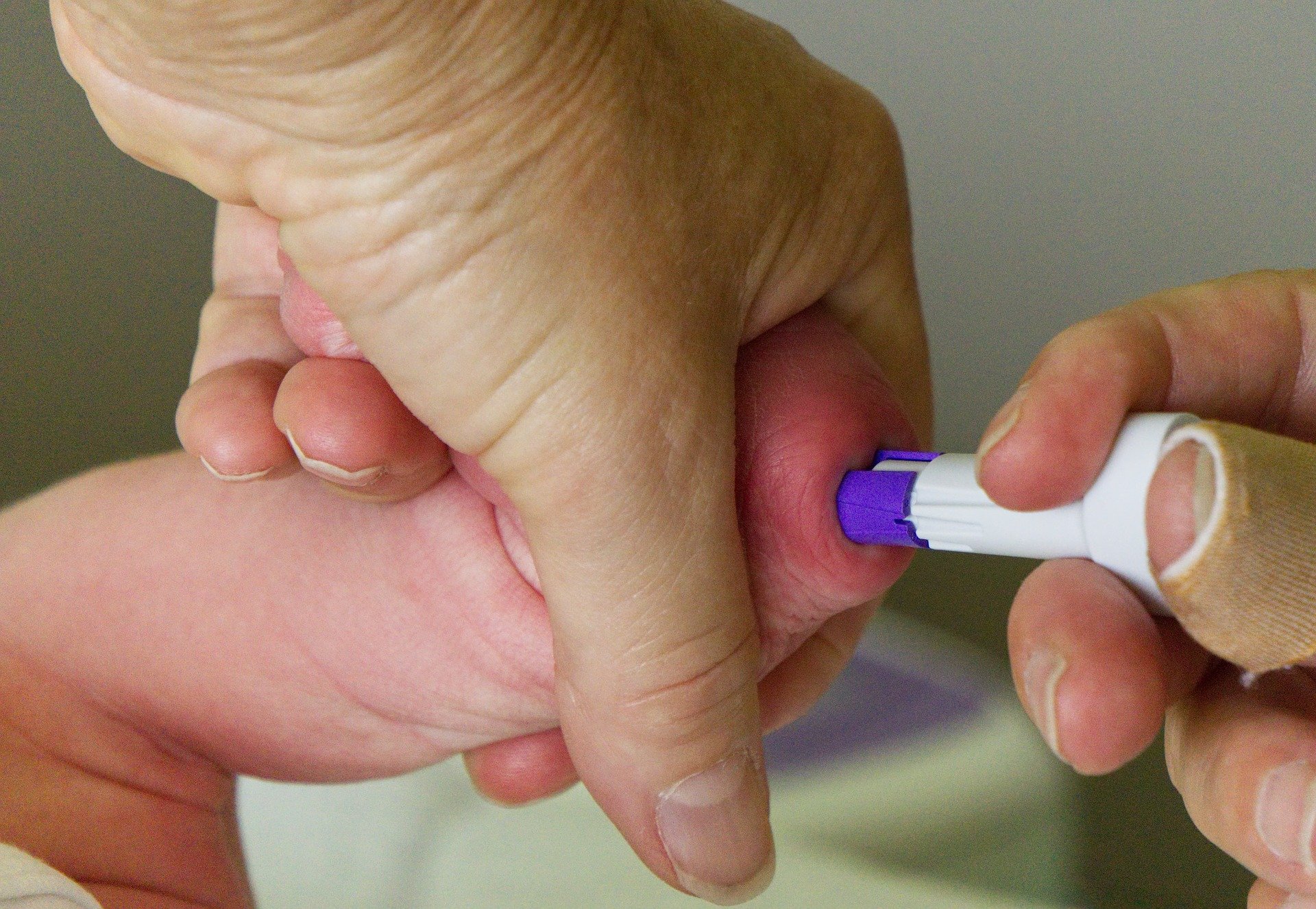 Uno screening neonatale per la diagnosi precoce di SMA e SCID in Liguria