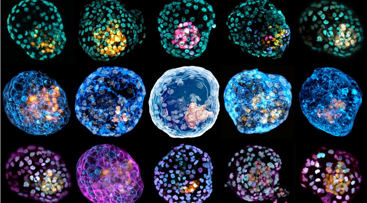 Medicina Rigenerativa: ottenuti primi embrioni umani sintetici - Credits: lens.monash.edu