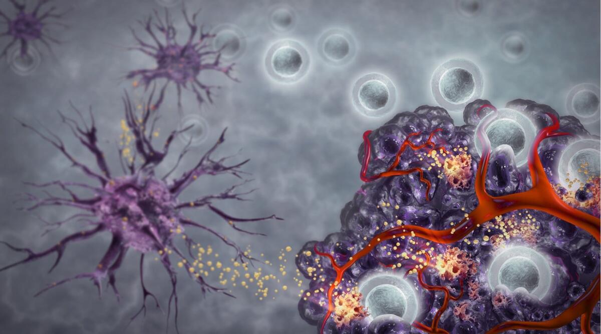 Tumori: scoperti i geni che determinano il successo dell'immunoterapia - Credits: Parker ICI