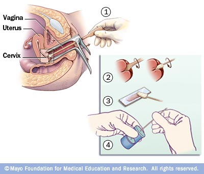 Credits: Mayo Foundation for medical education and research