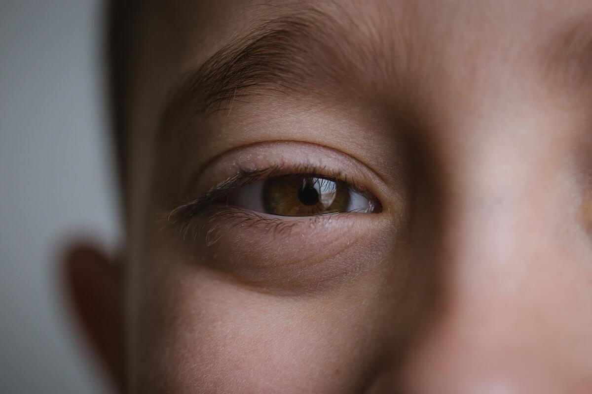 Un'innovazione per la diagnosi di "occhio pigro" in bambini molto piccoli - 