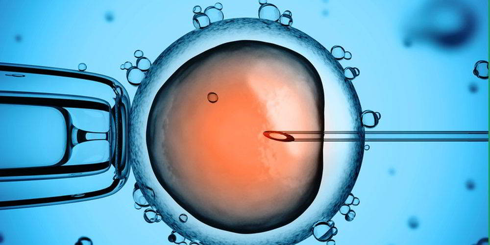Fecondazione in vitro: ICSI. Credits: ivi