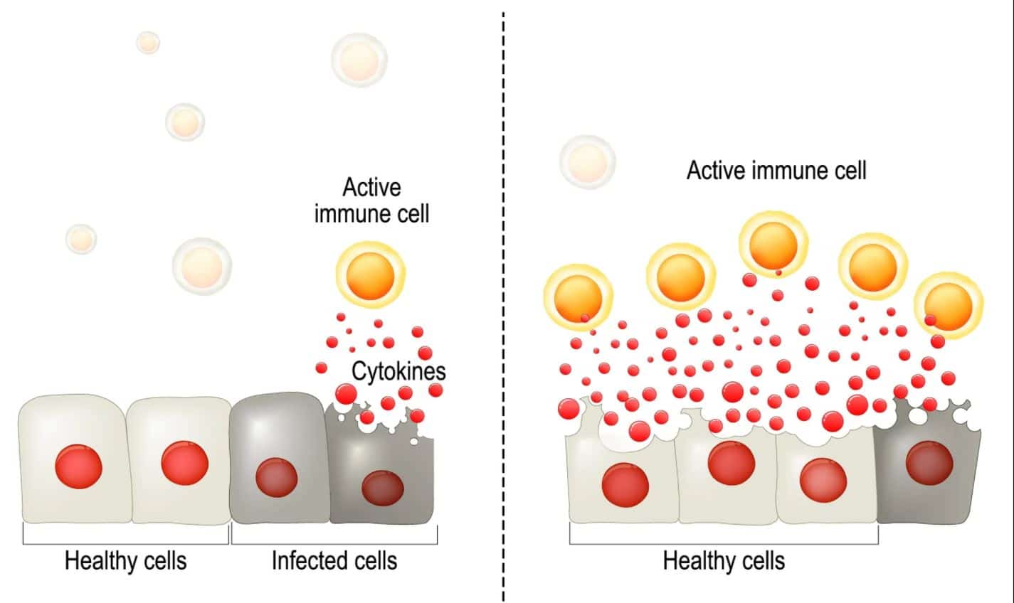 Risposta normale vs tempesta di citochine. Credits: News-medical