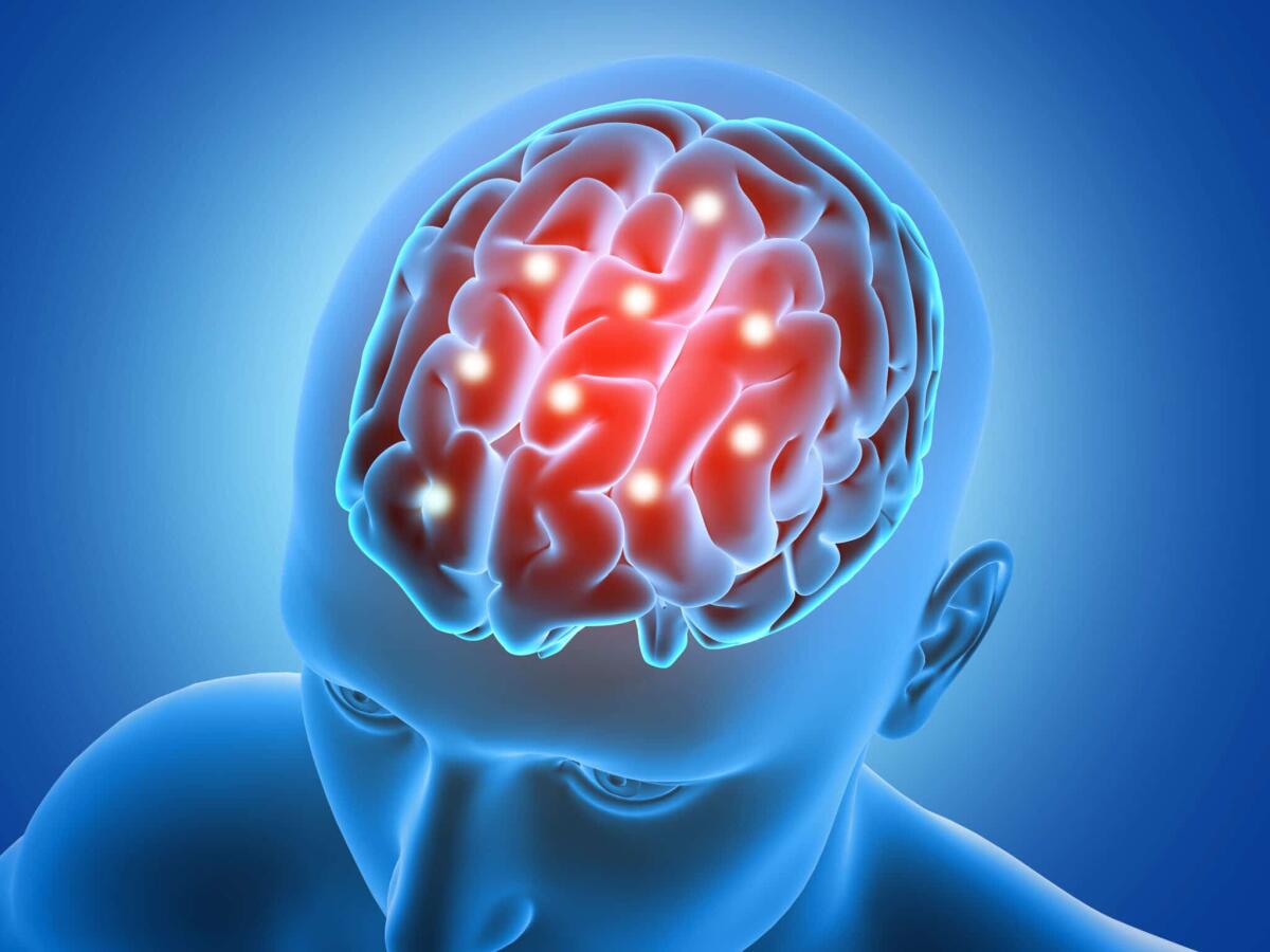 La BCI che legge la scrittura a mano dal cervello dell’uomo paralizzato - leucemia fulminante